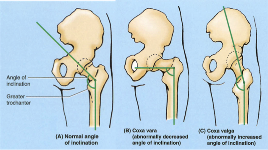 normal xray of hip joint