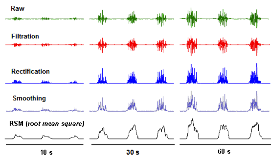 How To Measure Emg Signal at olivelmartino blog