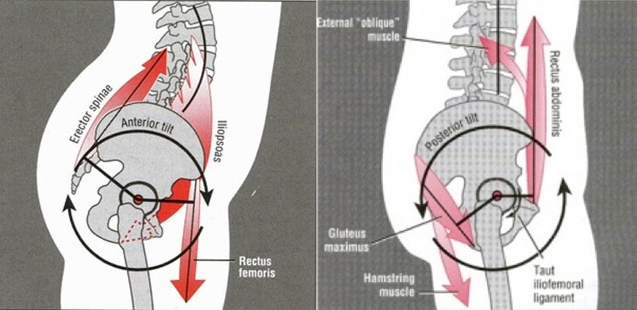 Pinchy Hips with Squatting?