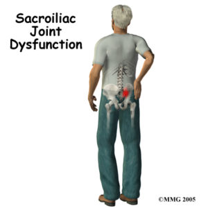 Tips to tame your Sacroiliac (SI) joint pain - reactive