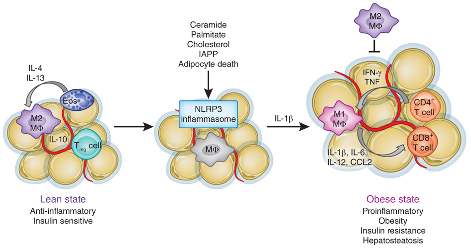 obesity and inflammation